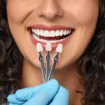 are veneers right for you pros & cons explained by kelowna dentists