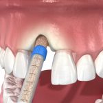 dental clinic in lloydminster