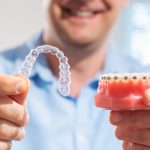 braces vs clear aligners which orthodontic treatment is right for you